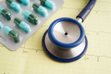 Stethoscope on electrocardiogram (ECG), heart wave, heart attack, cardiogram report.