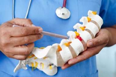 Omurga ve kemik modeli taşıyan Asyalı doktor, ortopedi bölümünde tedavi için bel kemiği yerinden oynamış disk parçası..