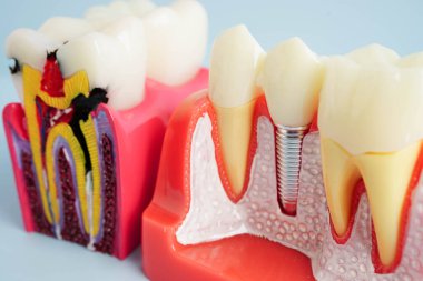 Diş hekimliği hakkında bilgi almak için beyaz arkaplanda diş modeli.