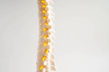 Omurga ve kemik, bel kemiği yerinden oynamış disk parçası, ortopedi bölümünde tedavi için model..