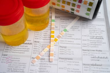 İdrar tahlili, reaksiyonlu idrar kabı. PH kağıt testi ve karşılaştırma tablosu laboratuvarda..