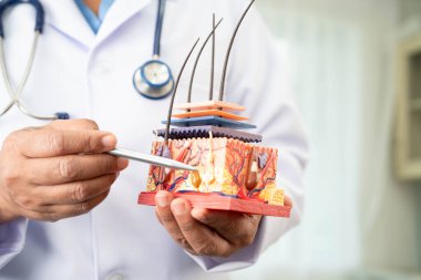 Saç nakli, Asyalı dermatolog hastanede tedavi için deri yapısı anatomisi modeli tutuyor..