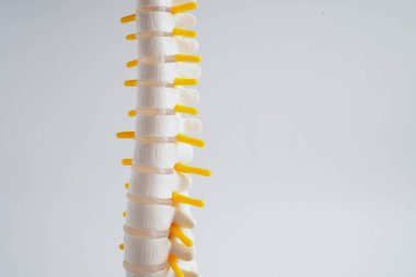 Omurga ve kemik, bel kemiği yerinden oynamış disk parçası, ortopedi bölümünde tedavi için model..