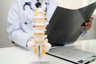 Doktor omurga röntgen filmini inceliyor..