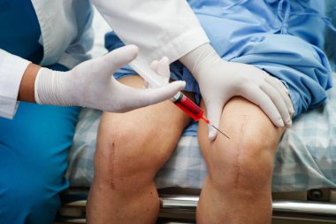 Asyalı doktor yaşlı kadının dizine Hyaluronic asit trombosit enjekte ediyor..