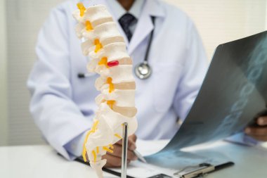 Doktor omurga röntgen filmini inceliyor..