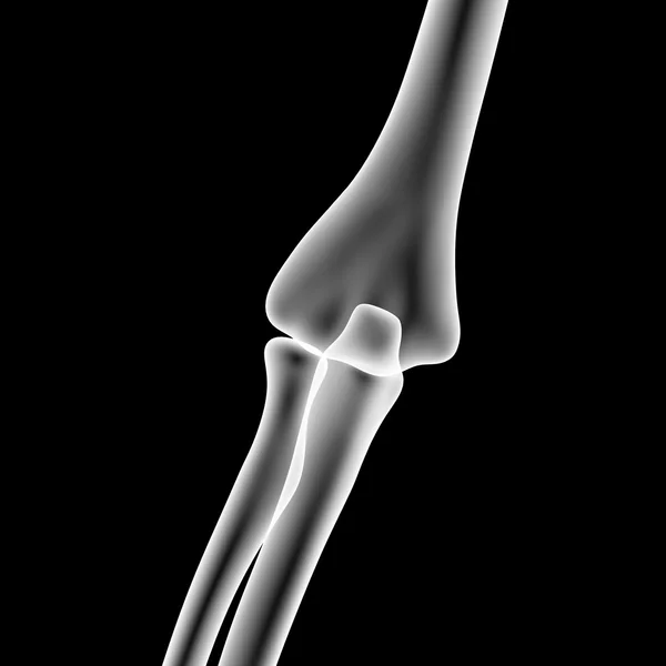 Articulação de cotovelo esqueleto humano — Fotografia de Stock