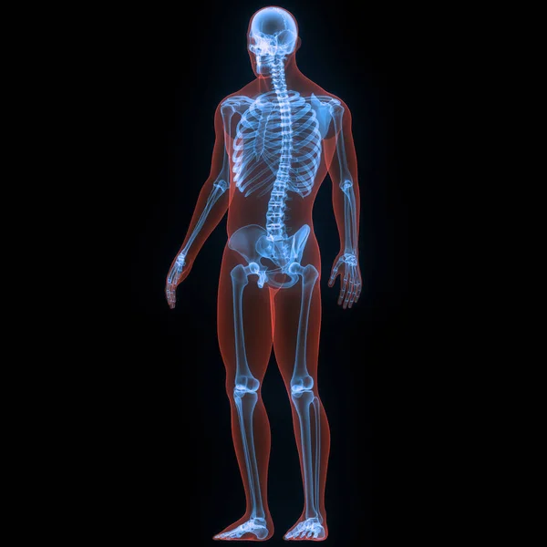 人体骨关节疼痛 髋关节和骨盆的腿关节 — 图库照片