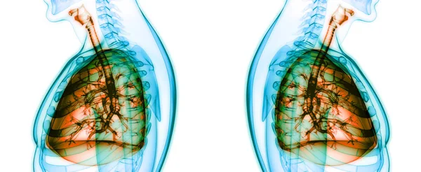 Concepto Anatomía Pulmonar Del Sistema Respiratorio Humano —  Fotos de Stock