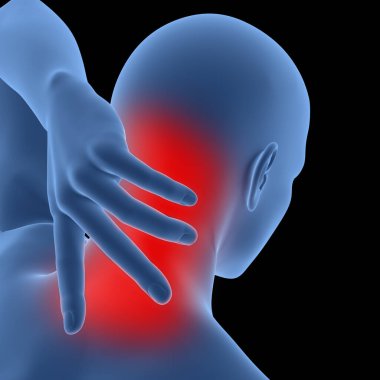 Servial Omurga Anatomisi 'nde boyun ağrısından muzdarip insan. Üç Boyut