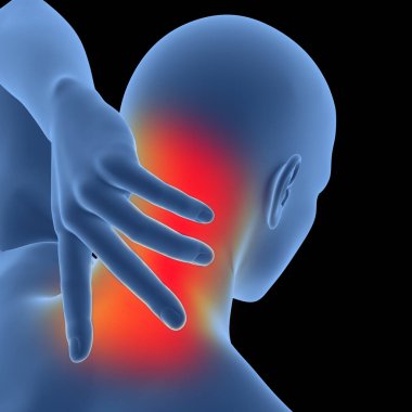 Servial Omurga Anatomisi 'nde boyun ağrısından muzdarip insan. Üç Boyut