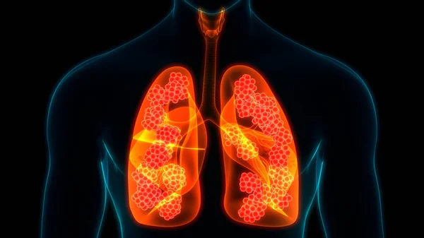 인간의 Human Respiratory System Lungs Anatomy — 스톡 사진