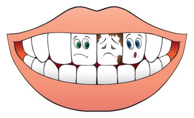 Two nervous teeth clipart