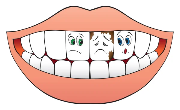 Dos dientes nerviosos — Vector de stock