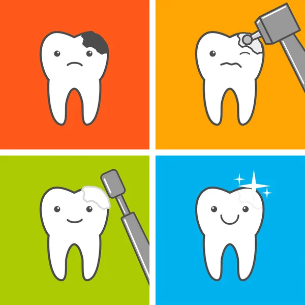 Processus de traitement des caries — Image vectorielle