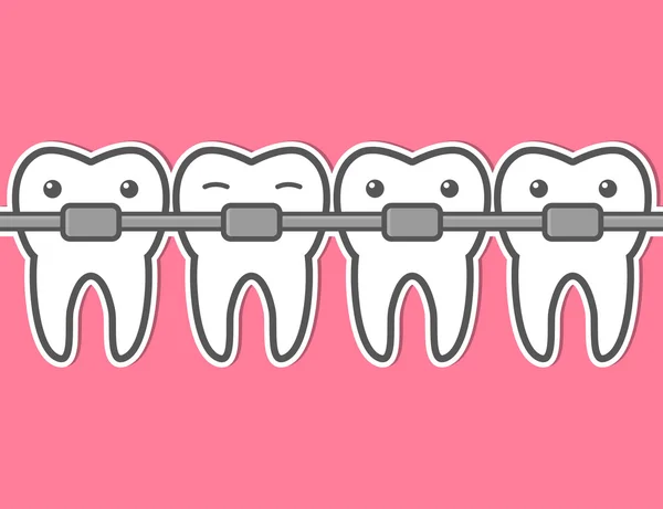 Frenos de dientes de dibujos animados . — Vector de stock