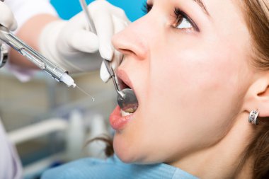 Resepsiyon kadın dişçideydi. Doktor diş çürümesi üzerine ağız boşluğu inceler. Çürükkoruması. Diş çürümesi tedavisi. Diş hekimi ofisinde diş kürkadın hasta
