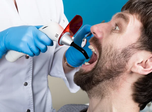 Läkaren undersöker munhålan på karies. Karies skydd. Tand förfall behandling. Tandläkare som arbetar med dentala polymerisation lampa i munhålan — Stockfoto