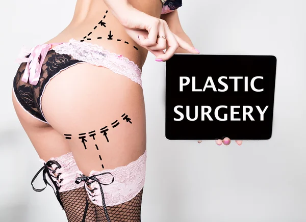 Young woman in lacy lingerie, holding a tablet pc with plastic surgery sign. Drawing lines on a Caucasian womans ass as marks for ass cellulite cosmetic correction surgery — Stock Fotó