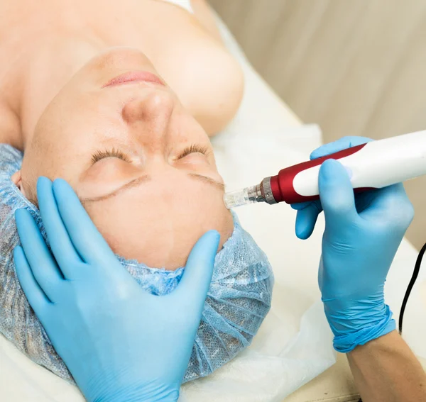 Beautician hace mesoterapia fraccionada a la mujer joven. Los procedimientos cosméticos para la cara. Tratamientos de belleza en el salón de spa. Cuidado facial de la piel —  Fotos de Stock