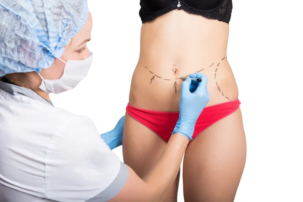 Il dottore femminile fa la linea tratteggiata su corpo femminile per correzione di cellulite. chirurgia estetica. sollevamento e aumento del seno — Foto Stock