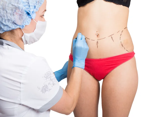 Femme médecin fait ligne pointillée sur le corps féminin pour la correction de la cellulite. chirurgie esthétique. levage et augmentation mammaire — Photo