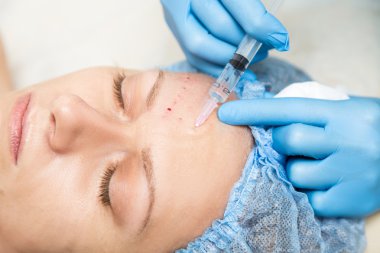 Şevval Özçelik Güzellik biorevitalization genç kadın için yapar. Yüz için kozmetik prosedürler. Güzellik bakımı spa salonda. Yüz Cilt Bakımı