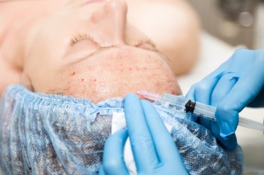 Şevval Özçelik Güzellik biorevitalization genç kadın için yapar. Yüz için kozmetik prosedürler. Güzellik bakımı spa salonda. Yüz Cilt Bakımı