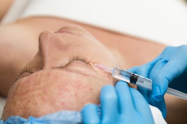 Şevval Özçelik Güzellik biorevitalization genç kadın için yapar. Yüz için kozmetik prosedürler. Güzellik bakımı spa salonda. Yüz Cilt Bakımı