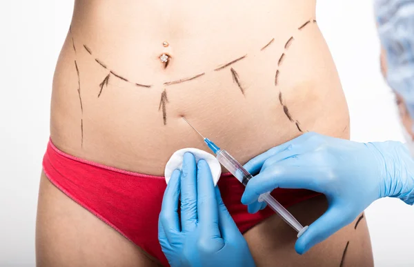 Female doctor makes dotted line on female body for cellulite correction. cosmetic surgery. lifting and breast augmentation. doctor makes beauty injection