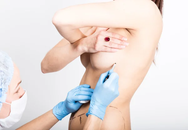 Femme médecin fait ligne pointillée sur le corps féminin pour la correction de la cellulite. chirurgie esthétique. levage et augmentation mammaire — Photo