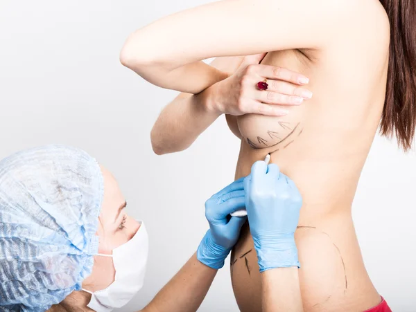 Kadın doktor noktalı çizgi selülit düzeltme için kadın vücudunda yapıyor. Kozmetik cerrahi. kaldırma ve meme büyütme