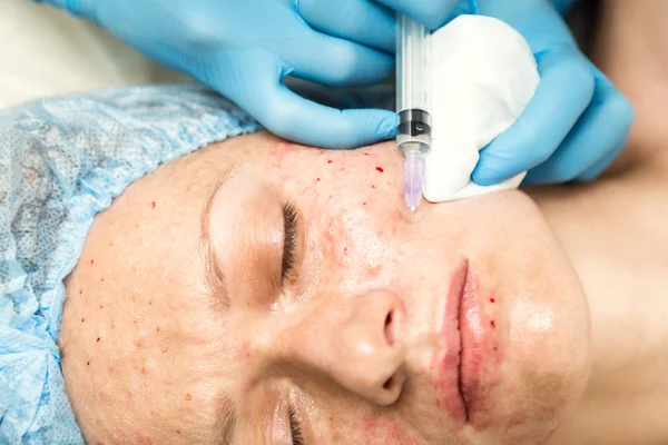 Beautician hace biorevitalización a la mujer joven. Los procedimientos cosméticos para la cara. Tratamientos de belleza en el salón de spa. Cuidado facial de la piel — Foto de Stock