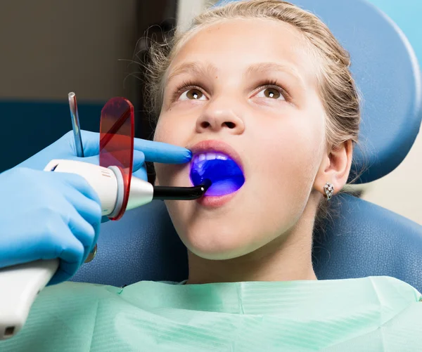 Gelukkig klein meisje met open mond tandheelkundige behandeling bij kliniek ondergaat. Tandarts gecontroleerd en genezen tanden van een kind-patiënt in de tandheelkundige kantoor — Stockfoto