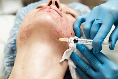 Şevval Özçelik Güzellik biorevitalization genç kadın için yapar. Yüz için kozmetik prosedürler. Güzellik bakımı spa salonda. Yüz Cilt Bakımı