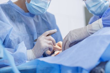 Modern bir klinikte, steril perdelerin altında biberli neşterle cerrahların ellerine yakından bakın.