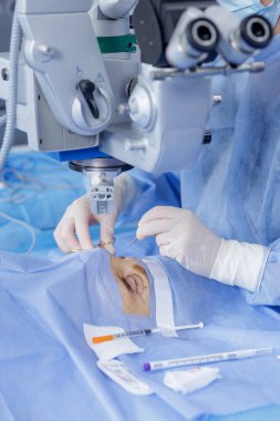 Eldivenli bir cerrah modern bir klinikte steril perdeler altında kan alma ameliyatı yaparken işaretli bir göz kapağı üzerinde mikroskop ameliyatı yapmak.