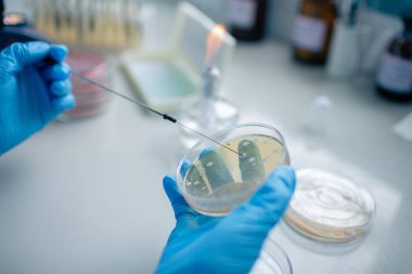 Eldivenli ellerin steril bir döngü ile bir Petri kabını aseptik mikrobiyoloji kültürünü ve test etmeyi gösteren bir ocağın yanında çırılçıplak gezdiğini yakından görmek.