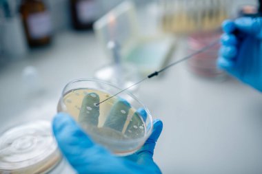 Agar üzerinde aseptik çizgi tekniğinin makro görünümü, bakteriyel araştırma ve tanı için döngü ve Petri kabını gösterir