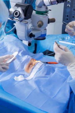 Oküloplastik ekibi steril modern bir klinikte mikroskop altında perdeli göz ve koterapi ile blefaroplasti gerçekleştiriyor..