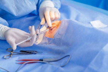 Göz kapağına steril perdeler ve enstrümanlar takmadan önce lokal anestezi enjekte eden bir oküloplastik cerrahı kapatın..