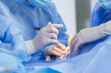 Cerrahın ellerini neşterle kapatın. Steril hastane operasyonu sırasında asistanla dikkatli bir kesik atın.