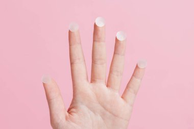 Parmak uçlarında şeffaf sivilce yamaları ve pastel pembe arka planda yüz bakımı kavramlarıyla el açık.