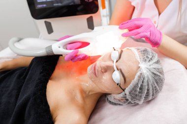 Kozmetik uzmanı koruyucu gözlük takan bayan müşterilere IPL yoğun titreşimli ışık prosedürü uyguluyor. Dermatoloji, estetik tıp ve cilt bakım hizmeti için ideal..