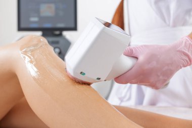 Kozmetik uzmanı estetik teçhizatla hastaların bacaklarında lazer tüyü alıyor. Dermatoloji klinikleri, güzellik salonları ve kozmetik tedavi reklamları için uygundur..