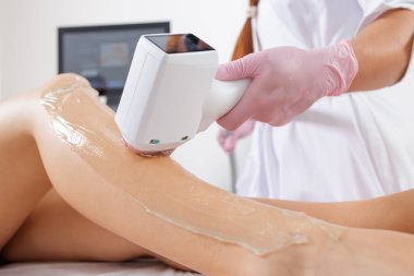 Kozmetik uzmanı, estetik aletle müşteri bacaklarında lazer tüyü alıyor. Dermatoloji klinikleri, güzellik salonları ve kozmetik tedavi reklamları için uygundur..