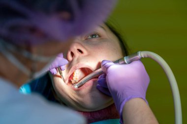 Erkek dişçiler genç bayan hasta üzerinde çalışıyor. Dişçi muayenehanesi. Dişçide sandalyede oturan gerçek bir kadın. Kapat. ses tonlu