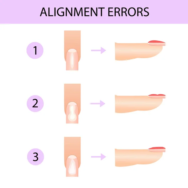 Alineación de la placa de clavos. Guía de manicura profesional, ilustración vectorial, infografías — Vector de stock