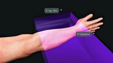 İskelet yapısını, kemiklerini, eklemlerini ve tanı görüntüleme sürecini gösteren tıbbi röntgenin 3D animasyonu