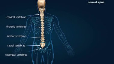 Skolyoz omurgasının 3d animasyonu anormal yanal eğri, duruş ve omur hizalaması gösteriyor.